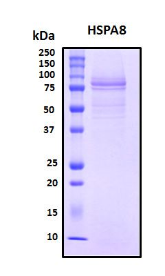 SDS-PAGE