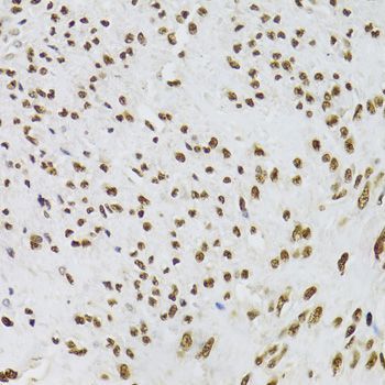 Immunohistochemistry - XRCC6 Polyclonal Antibody (144-00883)