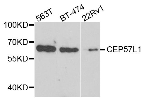 Western blot - CEP57L1 antibody (144-08290)