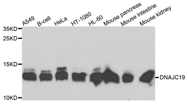 Western blot - DNAJC19 Polyclonal Antibody (144-05146)