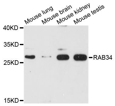 Western blot - RAB34 Polyclonal Antibody (144-010332)