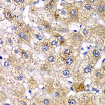 Immunohistochemistry - AMY2A antibody (144-08045)