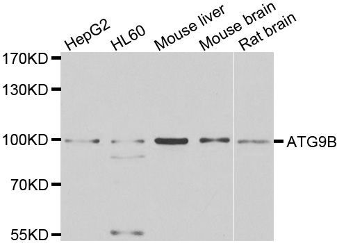 Western blot - ATG9B Polyclonal Antibody (144-07406)