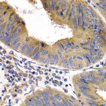Immunohistochemistry - HSPB8 antibody (144-02514)