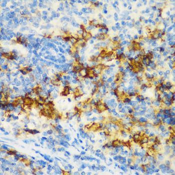 Immunohistochemistry - CD3D antibody (144-01238)
