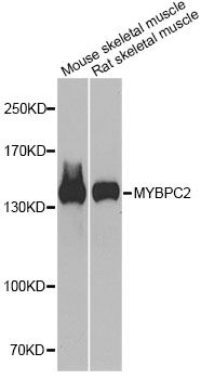 Western blot - MYBPC2 antibody (144-60286)