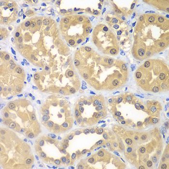 Immunohistochemistry - KHK Polyclonal Antibody (144-07440)