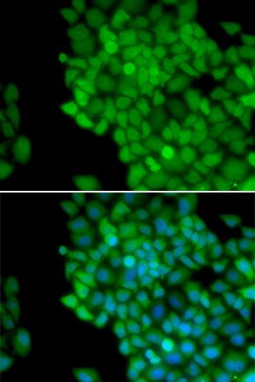 Immunofluorescence - MAGEA1 antibody (144-05470)