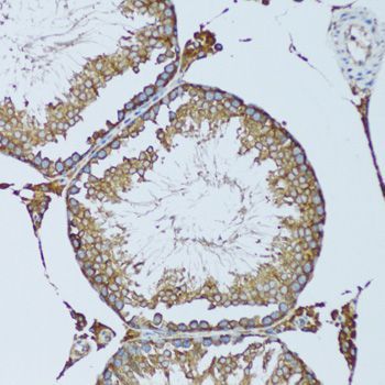Immunohistochemistry - RPN1 antibody (144-600827)