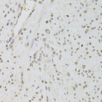 Immunohistochemistry - RUVBL1 Antibody (144-05723)