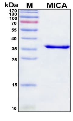 SDS-PAGE Image