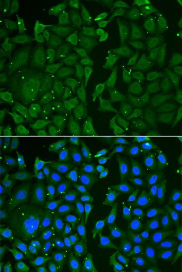 Immunofluorescence - TKT antibody (144-06314)