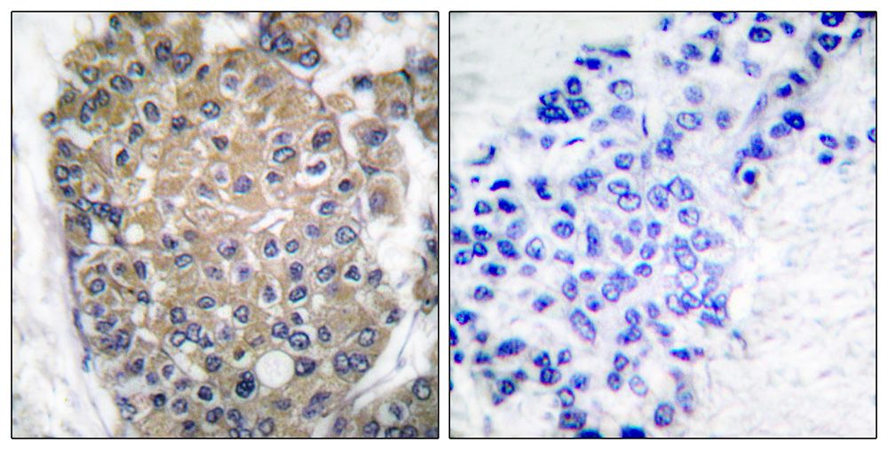 IHC