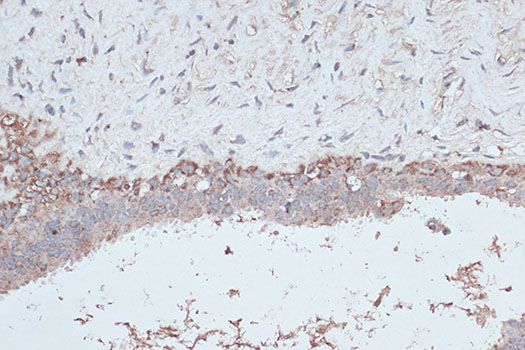 Immunohistochemistry - MAP1LC3B Polyclonal Antibody (144-07198)