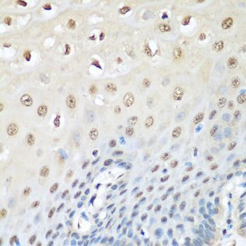 Immunohistochemistry - VCP Polyclonal Antibody (144-60308)