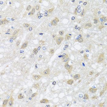 Immunohistochemistry - HARS2 antibody (144-07785)
