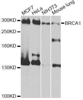 Western blot - BRCA1 Polyclonal Antibody (144-11549)