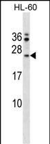 WB