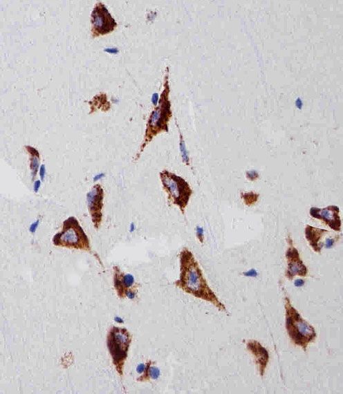 IHC-P