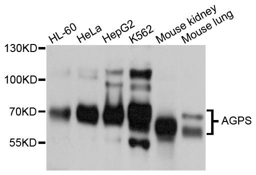 Western blot - AGPS Polyclonal Antibody (144-600554)