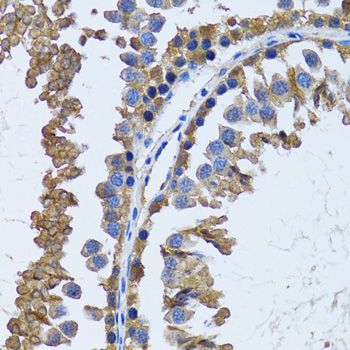 Immunohistochemistry - IMPA1 antibody (144-06381)