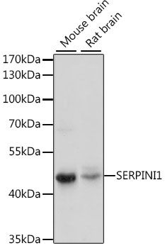 Western blot - SERPINI1 Polyclonal Antibody (144-015703)