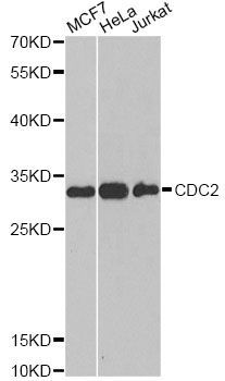 Western blot - CDK1 antibody (144-012414)