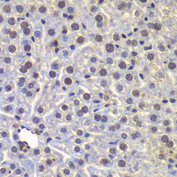 Immunohistochemistry - FUBP3 Polyclonal Antibody (144-07948)