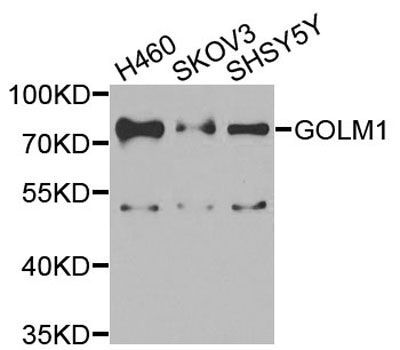 Western blot - GOLM1 Polyclonal Antibody (144-07283)
