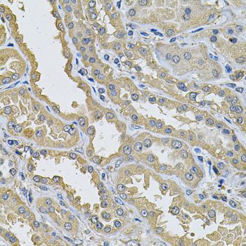 Immunohistochemistry - PPID Polyclonal Antibody (144-06949)