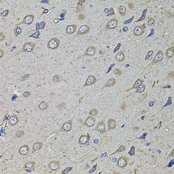 Immunohistochemistry - COL1A2 antibody (144-05786)