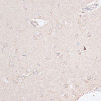 Immunohistochemistry - ABCF2 antibody (144-012555)