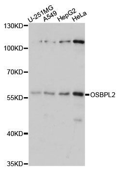 Western blot - OSBPL2 antibody (144-60601)