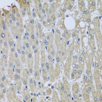 Immunohistochemistry - SYT11 antibody (144-08198)