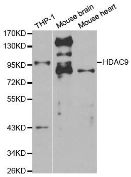 Western blot - HDAC9 Polyclonal Antibody (144-01516)