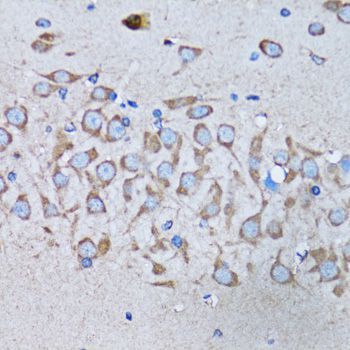 Immunohistochemistry - IRAK4 antibody (144-06208)