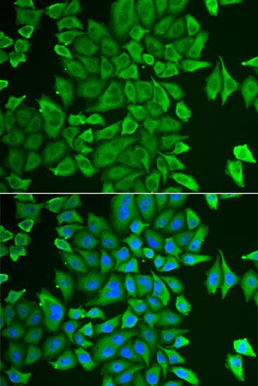 Immunofluorescence - APEH antibody (144-603447)