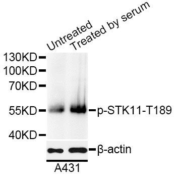 Western blot - Phospho-STK11-T189 antibody (144-50603)