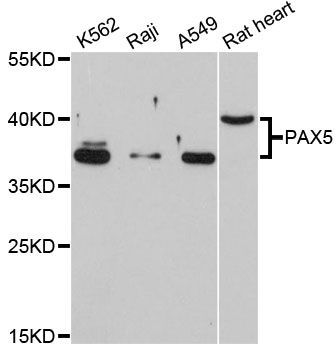 Western blot - PAX5 antibody (144-12048)
