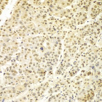 Immunohistochemistry - Lamin A/C Polyclonal Antibody (144-00249)