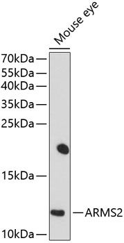 Western blot