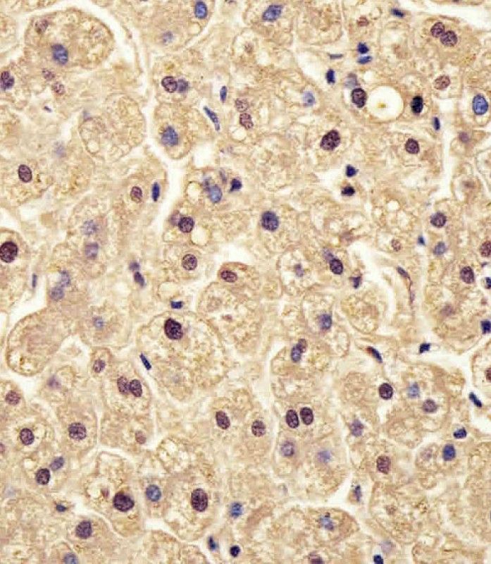 IHC-P