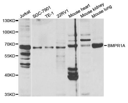 Western blot - BMPR1A antibody (144-01816)