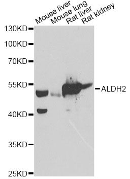 Western blot - ALDH2 Polyclonal Antibody (144-603443)