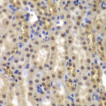 Immunohistochemistry - SMARCB1 Polyclonal Antibody (144-05767)