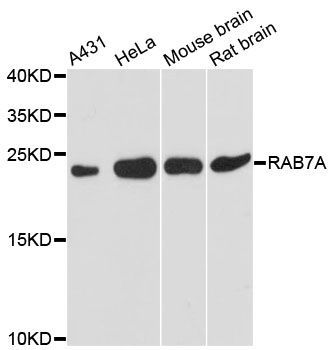 Western blot - RAB7A Polyclonal Antibody (144-60102)