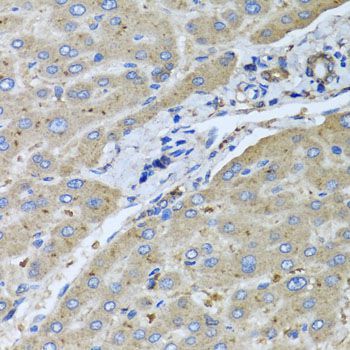 Immunohistochemistry - UGT2B10 antibody (144-07570)