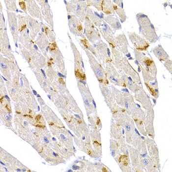 Immunohistochemistry - DSP Polyclonal Antibody (144-60272)