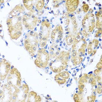 Immunohistochemistry - BNIP3L antibody (144-06283)
