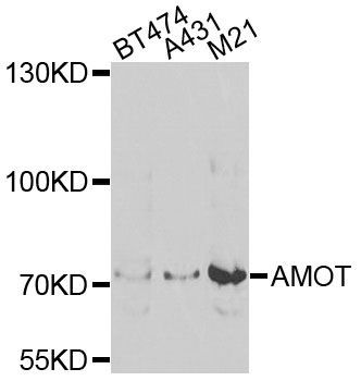 Western blot - AMOT Polyclonal Antibody (144-08075)